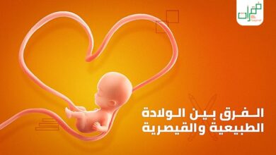 الولادة الطبيعية والولادة القيصرية