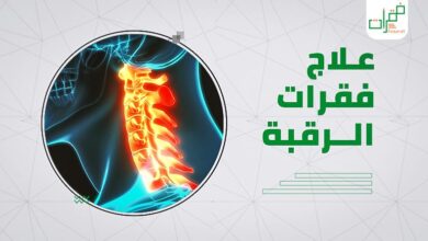 علاج فقرات الرقبة