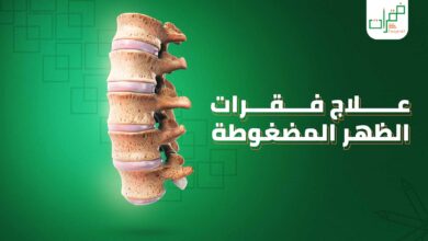 علاج فقرات الظهر المضغوطة