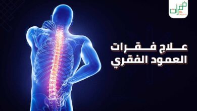 علاج فقرات العمود الفقري