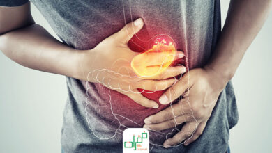 قرحة المعدة