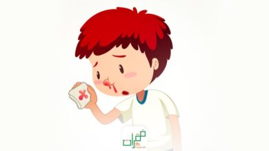 أسباب نزول الدم من الأنف
