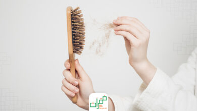 علاج تساقط الشعر