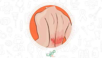 الحزام الناري