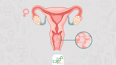 علاج التهابات المهبل