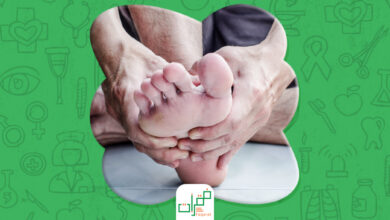 علاج تينيا القدمين