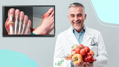 النظام الغذائي لمريض النقرس